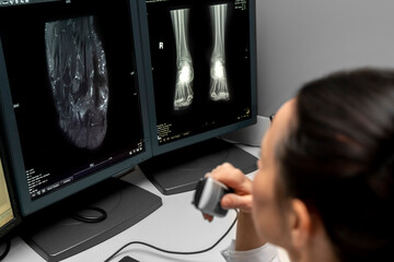 radiology doctor examines foot, ankle x-ray, mr image and reports with microphone looking computer...