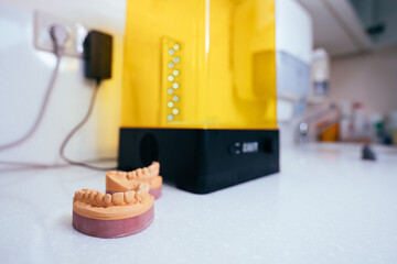 Device for washing a dental 3d print in a cleaning solution, and curing the mold using UV light