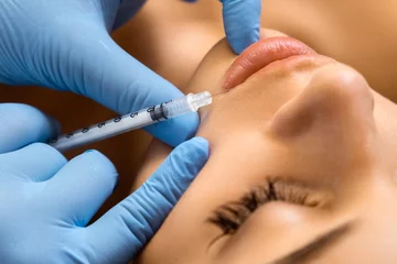 Deurstickers Schoonheidssalon Lip augmentation procedure with hyaluronic acid in a beauty salon.