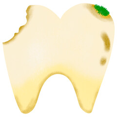 tooth decay