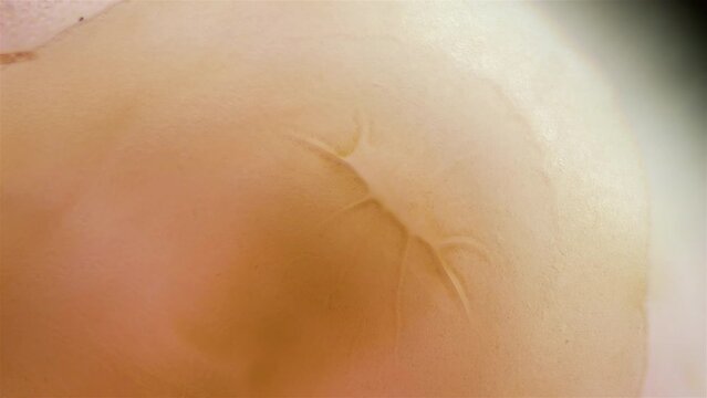 Mollusca Tonicella marmorea under microscope, order Chitonida. The video shows mouth close up. White Sea