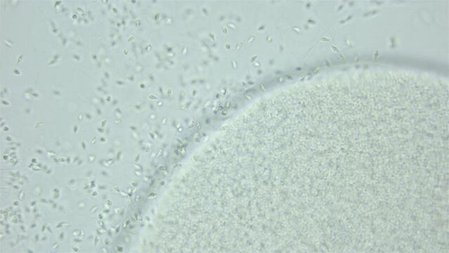 Sperm and ovule sea urchin Strongylocentrotus pallidus under microscope, phylum Echinodermata. White sea