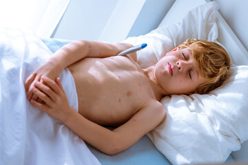 Obraz na płótnie Canvas Boy with chickenpox measuring temperature