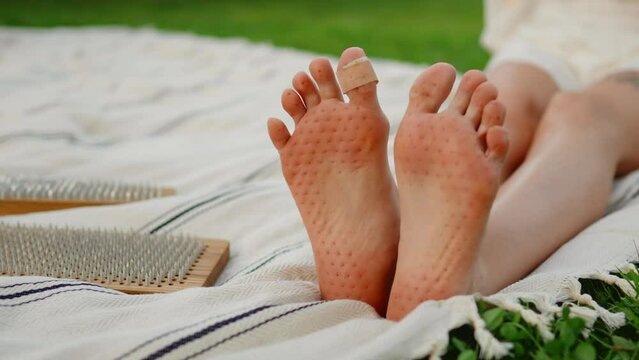 Woman's feet after standing on boards with nails.