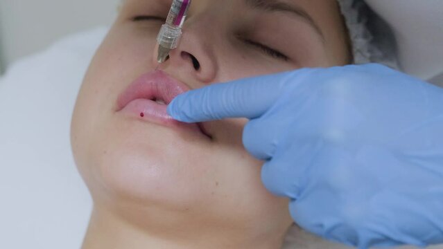 Close-up shot of lips augmentation procedure in the aesthetic cosmetology clinic. Cosmetologist makes contouring plastic to increase the volume of female patient lips.