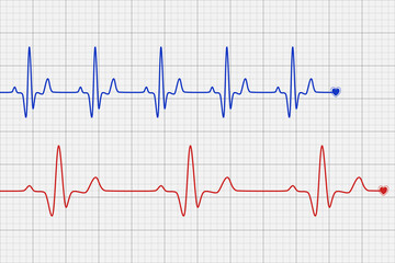 Blue and red heartbeat diagram on grey graph paper for Cardio test line. Minimal Vector Design.