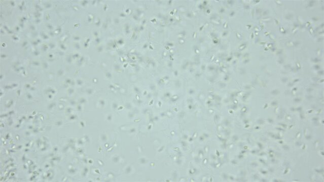 Sperm sea urchin Strongylocentrotus pallidus under microscope, phylum Echinodermata. White sea