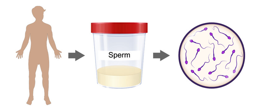 Male reproductive system. Semen analysis vector. Medical Sample in Glass Tube. Sample sperm. Donor Sperm.