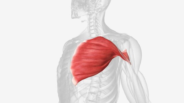 A pectoralis major strain refers to a tear in the large muscle which covers the chest