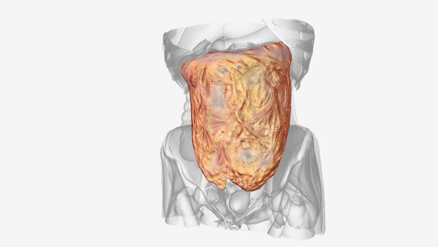 The greater omentum is the larger of the two peritoneal folds
