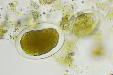 Egg of Hookworm in human stool, analyze by microscope, original magnification 400x