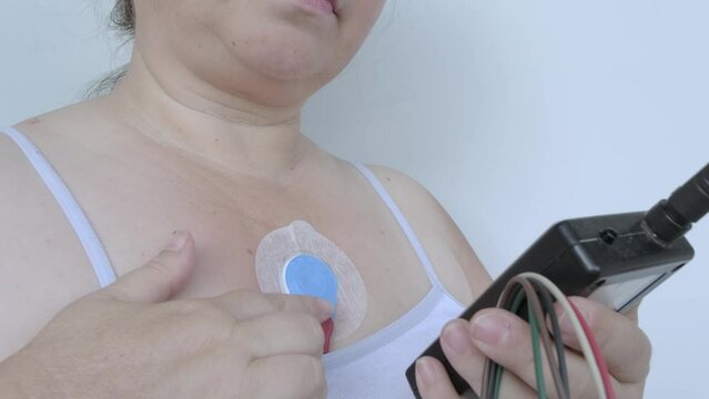 sensors on female body for Holter monitoring, woman with Holter monitor for daily monitoring of electrocardiogram, blood pressure, cardiac examination, treatment of cardiac diseases