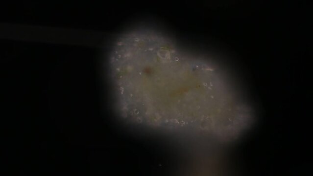 Study of Protozoa, Algae and bacteria under the microscope for education.