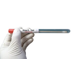 Vaginal swab for Strep B testing in microbiologist hand on white background.