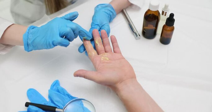 Examination laborant applying special cream to male fingers to take sample of cracked skin. Nurse in gloves scrubbing and applying alcohol slow motion