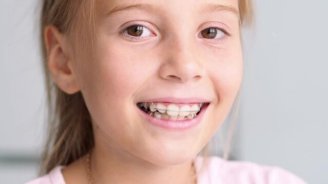 Children's teeth large with a cap. Bracket system on the teeth. Alignment of teeth with a dental plate. Malocclusion in a child. Crooked teeth. The concept of pediatric dentistry.