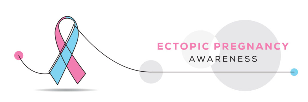 Ectopic Pregnancy awareness, banner design.