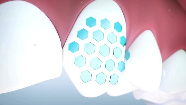 High quality animation 3D showing the process of teeth cleaning