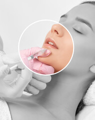 Cosmetologist does injections for lips augmentation and anti wrinkle in the nasolabial folds of a...