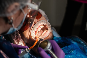 professional dental cleaning at the dentist. oral hygiene. dental care