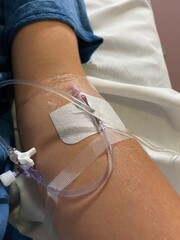 a person receiving a blood transfusion in a hospital