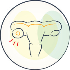 Ovarian cysts Diagnosis and treatment icon