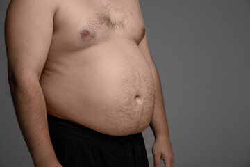 Overweight man with big belly on gray background with copy space. Fat hairy belly of a caucasian...