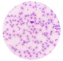 Trypanosoma sp. among red blood cells. Trypanosome species in blood from cattle.  Trypanosoma is a...