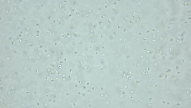 Sperm sea urchin Strongylocentrotus pallidus under microscope, phylum Echinodermata. White sea