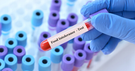 Fototapeta premium Doctor holding a test blood sample tube with food intolerance test on the background of medical test tubes with analyzes.Copy space for text