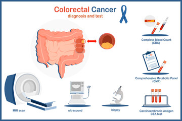 Medical vector illustration concept. Human colon and colon cancer. Colon cancer diagnosis and screening test, MRI scan, ultrasound, biopsy, blood test