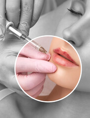 Cosmetologist does injections for lips augmentation anti wrinkle injections on the face of a...