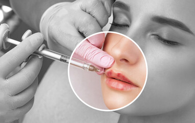 Cosmetologist does injections for lips augmentation anti wrinkle injections on the face of a...