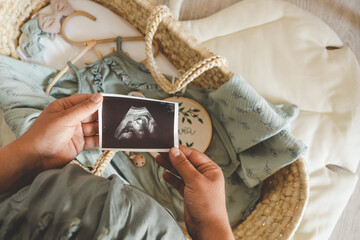 Ultrasound picture pregnant baby photo. Woman holding ultrasound pregnancy image. Concept of pregnancy, maternity, expectation for baby birth
