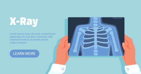 Hands with xray concept. Character in medical gown analyzes xray of patient. Diagnosis and treatment. Radiography and fluorography. Healthcare and medicine. Cartoon flat vector illustration
