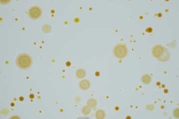 寒天培地に生育した細菌のコロニー