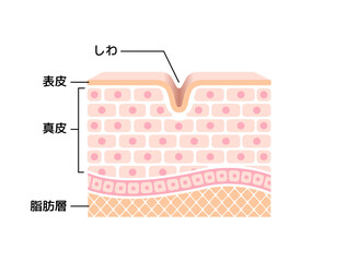 しわの発生した皮膚断面図 図解イラスト