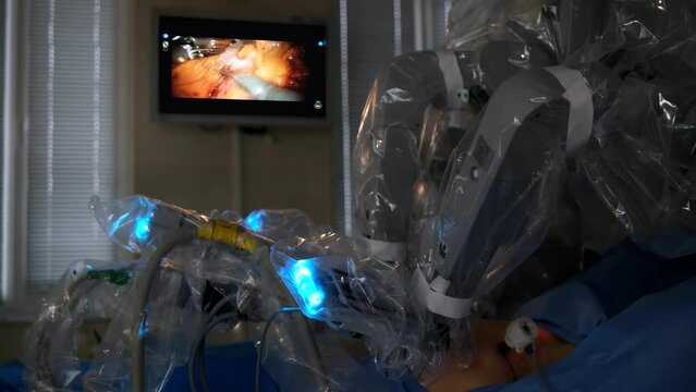 Modern surgical system. A medical robot performs surgery in the operating room. Minimally invasive robotic surgery.