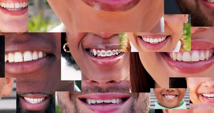 Dental, happy and mouth collage with people in a collection together for diversity, unity or inclusion. Smile, teeth or lips with a montage of natural men and women closeup for hygiene or oral care