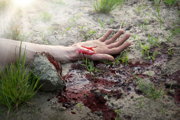 Bloodied hand lies on the ground