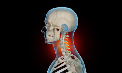 Side view of cervical section of spine injury and pain