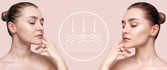 Woman before and after lifting skin. Infographic shows deep penetration of remedy in skin.