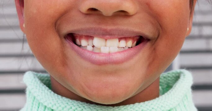 Smile, happy and closeup of mouth of girl in city for happiness, joy and facial expression. Dental care, childhood and face zoom of child for teeth whitening for confidence, pride and oral health