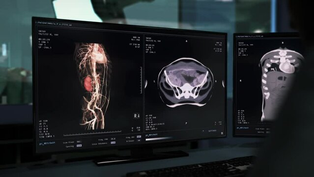 X-ray used for health analysis of the emergency patient at the hospital. X-ray health analysis of the body organs. Analysing the health condition of the patients kidneys with x-ray technology.