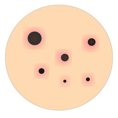 vector acne face beauty illustration