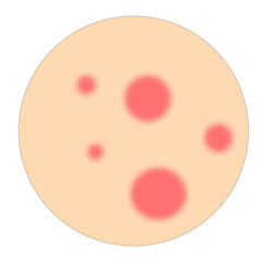 Fototapeta premium vector acne face beauty illustration