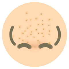 vector acne face beauty illustration