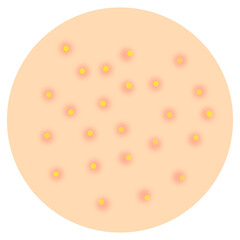 vector acne face beauty illustration