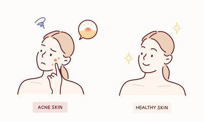 cartoon woman with acne skin problem. Hand drawn style vector design illustrations.