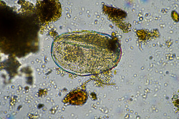 microbial organisms under the microscope in a lab